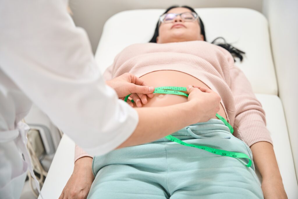 Gastric Sleeve surgery